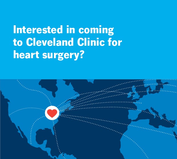 Interested in coming to Cleveland Clinic for heart surgery?